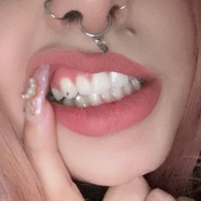 Women posting their teeth online.
Tag me.