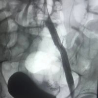 Somerset Interventional Radiology(@SomersetIRads) 's Twitter Profile Photo