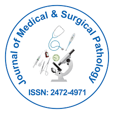 Journal of Medical & Surgical Pathology
ISSN: 2472-4971
(NLM ID: 101689989)
Email: info@longdom.org