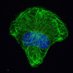 Connecting Intermediate Filaments Seminars (@connectingifs) Twitter profile photo Connecting Intermediate Filaments Seminars (@connectingifs) Twitter profile photo