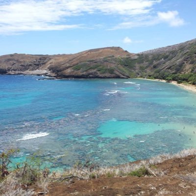 令和5年11月5日、血便が出るようになる。令和6年3月7日、大腸ガンとの診断。これからCT等で詳細検査へ。子供3人いるパパ。1番下は1歳です。手術後、ステージ3bになりました。