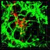 Guerrero-Cazares lab (@hugoguerrerolab) Twitter profile photo Guerrero-Cazares lab (@hugoguerrerolab) Twitter profile photo