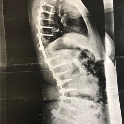 orthofen23's profile picture. Ortho/Unfall/Notfall. Tags Knochenhausarzt. Nachts Bereitschaftsdienstarzt. Zwischendurch Impfluencer. #PLURV. Nicht erschrecken: manchmal derb im Ton
