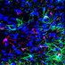 Chandra Lab (@schandralab) Twitter profile photo Chandra Lab (@schandralab) Twitter profile photo
