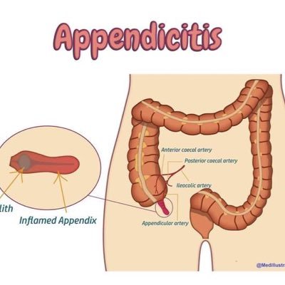 A medical Illustrations page with valuable information about various clinical cases. You can use our images for free in your medical articles @malkeasaad