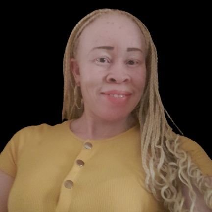 An Economist, Entrepreneur in the Fashion industry (Beads, Ankara and Leather bags and foot wears) and Advocate for Persons with Albinism