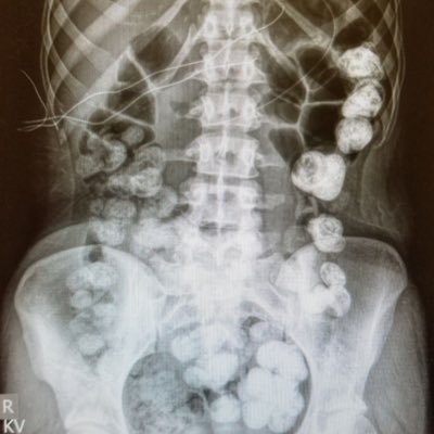 illest_ileus's profile picture. This account is some shit haha get it.