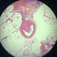 Pathologie Clermont (@pathologieclf) 's Twitter Profile