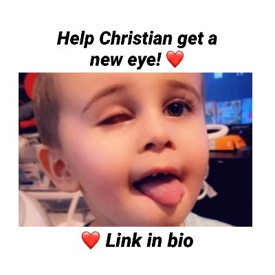 My nephew needs to get a prosthetic eye & it is very expensive! If you are able to donate or share it would mean a lot! Thank you! ❤️ https://t.co/IRvH8zwC3l