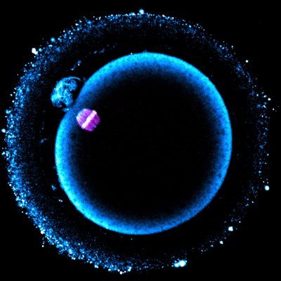 Research group of human gametogenesis and early embryogenesis @Science_MEDMUNI