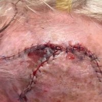 The Laceration Course (@thelaccourse) 's Twitter Profile