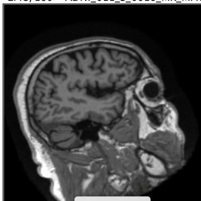 brainscanology's profile picture. Send us your brain MRI and we'll send you an objective risk score of bipolar disorder, schizophrenia, Alzheimer's disease, and more.