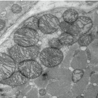 WCMR Mitochondria and muscle pathology(@mitomusclelab) 's Twitter Profile Photo