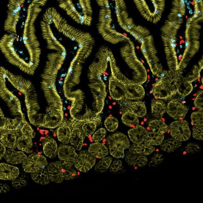 Max Planck Research Group Systems Immunology: @Kamu_Lab, @GeorgGasteiger, @dominic_grun, Vaeth & @MGomezAguero Labs. T cells, ILCs, Metabolism, Microbiome