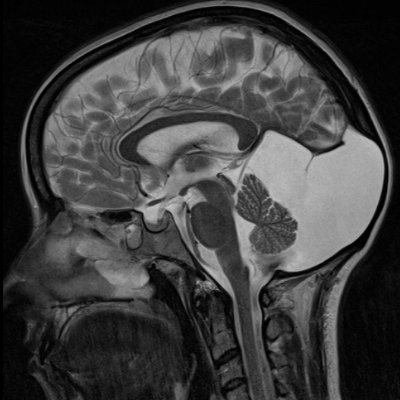 Doctor 🩺
Wife & Mum 👩👩👧👦
Bipolar, ADHD, EDS, PKD 🧬
(Yes that is my brain in the pic) 🧠
She/her 🏳️🌈