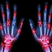 MsdEpidemiology's profile picture. Miami University - Musculoskeletal Disorders