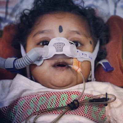 JanishFightsSma's profile picture. Janish is fighting a Rare Genetic disease- Spinal Muscular Atrophy, required all your support to save his life. Janish is 10month old. Plz share and support