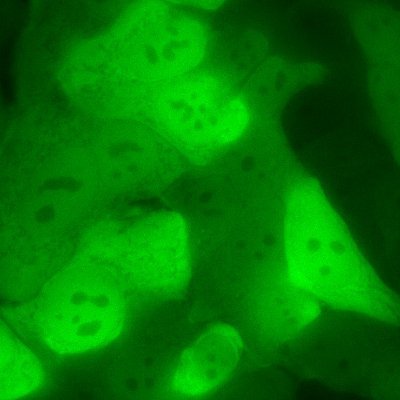 Medicinal chemistry and biology research group at UCT Prague. Studying novel anticancer theranostic compounds, fluorescent probes, and biocompatible materials.
