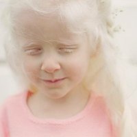 Albinism News 🌻(@Albinism) 's Twitter Profile Photo