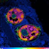 nanoSIMS@UWA (@simsnano) 's Twitter Profile