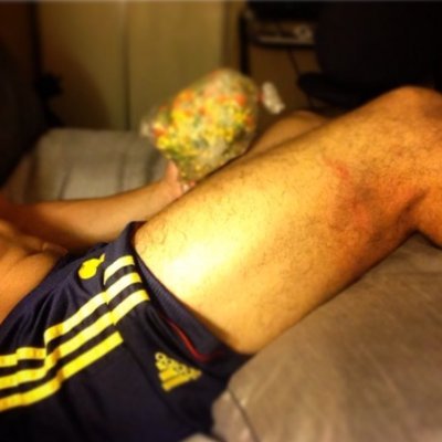 MrZuspan's profile picture. Criterio mayor de complicaciones