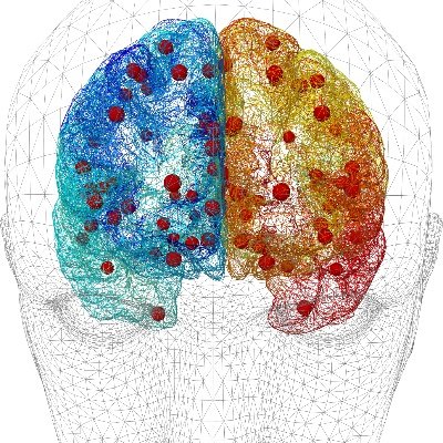 The human multiscale brain connectome and its variability – from synapses to large-scale networks and function. Workpackage 1 of the Human Brain Project SGA3.