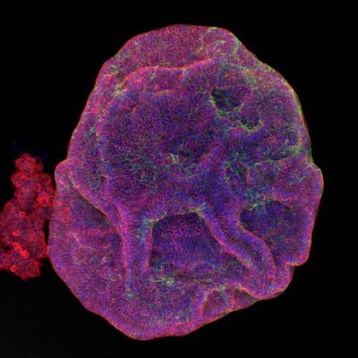 Research in the Sawyers Lab focuses on prostate cancer and new therapeutic strategies to block cancer progression.
https://t.co/QwZBe3UYCw