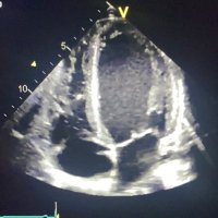 Josefin Elzén (@echography) 's Twitter Profile