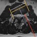 tecnicavertebral (@spineinjections) Twitter profile photo tecnicavertebral (@spineinjections) Twitter profile photo