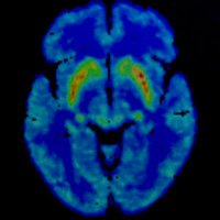 Integrative Neuroscience of Cognition and Aging (@inca_lab) 's Twitter Profile Photo