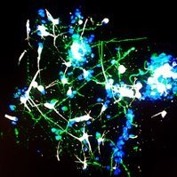 Bioengineering & Nanomedicine Group (@the_oommen_lab) 's Twitter Profile