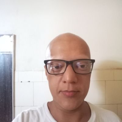 Passando uma situação muito difícil preciso de ajuda tenho ALOPECIA, VITILIGO E TIREÓIDE não consigo mais pagar os tratamento médicos 
Contribuir Agora👇👇👇