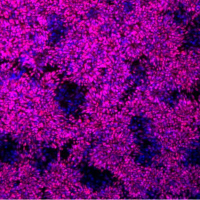 @ASAP_Research's @Jakobssonlab Team. Co-PIs: @PDandHDLab, @MollyHammell & @Kirkeby_Lab. We're studying activation of transposable elements in #ParkinsonsDisease