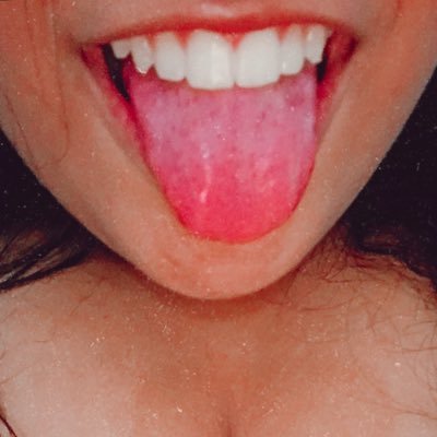 🦋✨