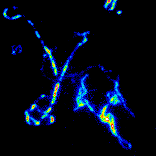 Our lab studies proteasomes in proteotoxic stress in neurons leading to dementia. Tweets by lab members, our vivid lives here: https://t.co/ZVAK2OQGBN