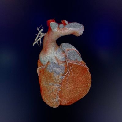 Imagen Cardiovascular INCMNSZ