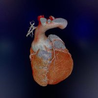 Imagen Cardiovascular INCMNSZ (@iincmnsz) 's Twitter Profile Photo