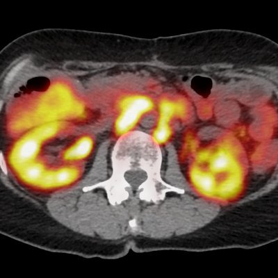 SNMMI Correlative Imaging Council Profile