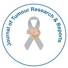 Journal of Tumor Research & Reports is an open access journal which covers different areas of all the tumors and cancer.
Bella Adley
Managing Editor