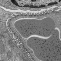 Bristol Renal (@bristolrenal) 's Twitter Profile Photo Bristol Renal (@bristolrenal) 's Twitter Profile Photo