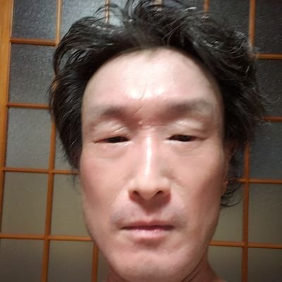 大阪のアトピー治療院さんの黄色ブドウ球菌撃退法を始めてもうすぐ4ヶ月がたち、劇的に回復しつつあります🙌最初の1～2ヶ月は好転反応でかなり辛く会社を欠勤していました。ステロイドも飲み薬も無しで、たった4ヶ月でここまでアトピーがよくなり静かに眠れるのが嬉しいです。#アトピー治療院　#黄色ブドウ球菌撃退法　#アトピー運動部