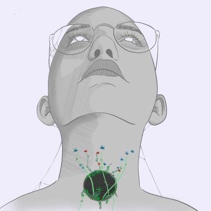 My journey to try and cure my Idiopathic Subglottic Tracheal Stenosis. 
Pictures and videos may be upsetting, esp if triggered by suffocation.