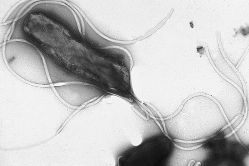 mide ve duodenum'um çeşitli alanlarında yerleşen, gram (-), mikroaerofilik bir bakteri