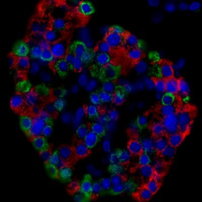 Official twitter account of Dr. Peter Light's research team / University of Alberta / Alberta Diabetes Institute // Stay tuned for our latest articles!