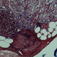 Orthopedic Surgery Research Lab (@microortho) 's Twitter Profile Photo