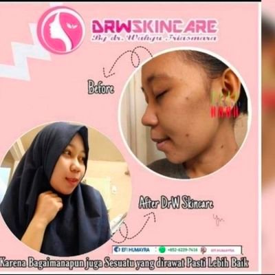 beauty consultan resmi drwskincare
memberikan solusi masalah kulit wajah dan badan. sesuai keluhan. perawatan dari rambut sampai kaki