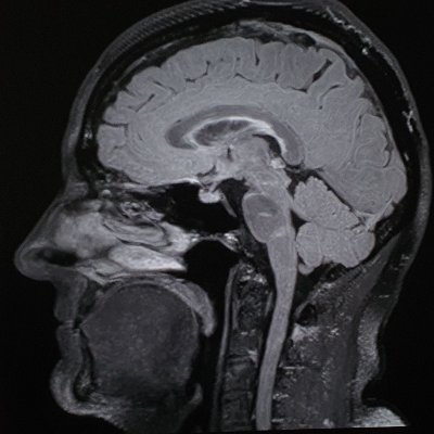 REmmental's profile picture. #Radiologie | #Neuroradiologie | RSE Spital Emmental, #Burgdorf, #Langnau, Kanton #Bern, #Schweiz #radiology #neuroradiology #Switzerland