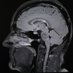 Radiologie & Neuroradiologie || Spital Emmental (@remmental) Twitter profile photo Radiologie & Neuroradiologie || Spital Emmental (@remmental) Twitter profile photo