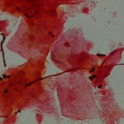 Cryptococcus17's profile picture. 