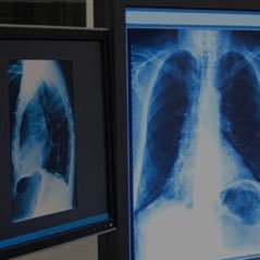 Radiologic World☢ Profile
